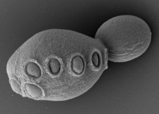Yeast has half its DNA rewritten in quest for synthetic complex cells