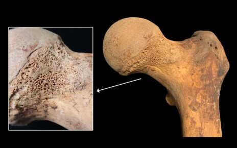 Traces of cannabis found in pre-modern human bones for the first time