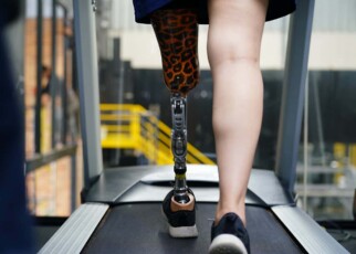person with prosthetic limb