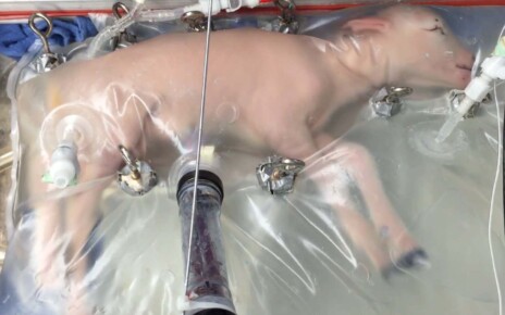 https://www.nature.com/articles/ncomms15112 Typical activity and appearance of a developmentally equivalent (107 day gestation) lamb fetus to a 23 ? 25 week gestation human infant during a run (day 5). SCREENGRAB - Supplementary Movie 1