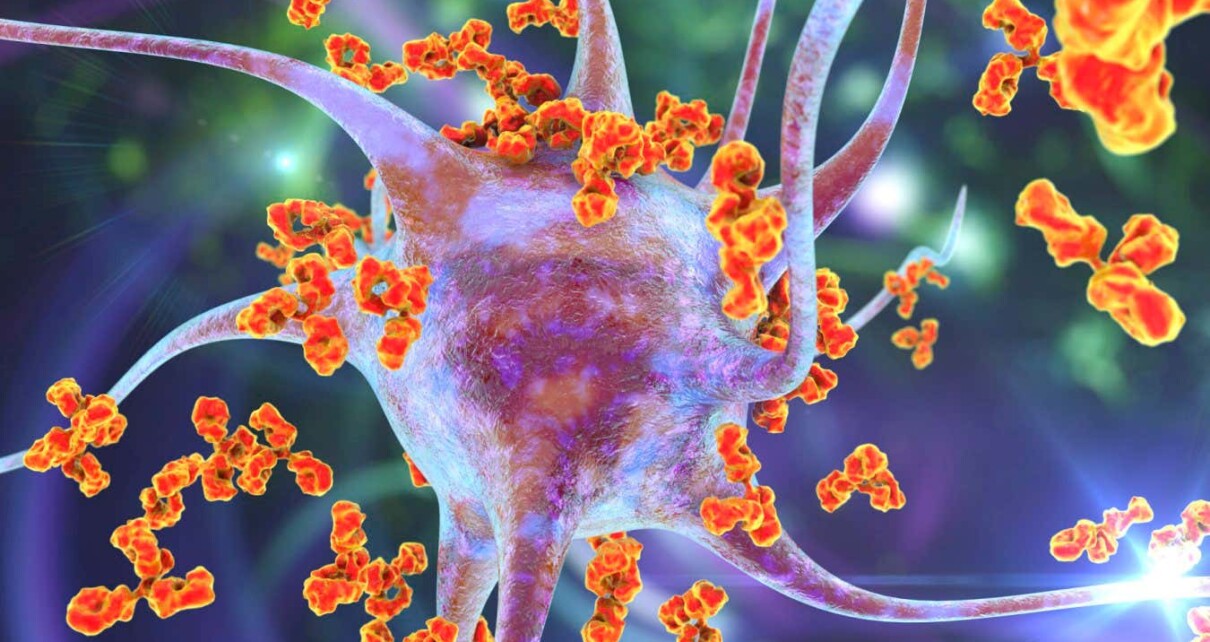 Multiple sclerosis genes may have arisen to ward off animal infections