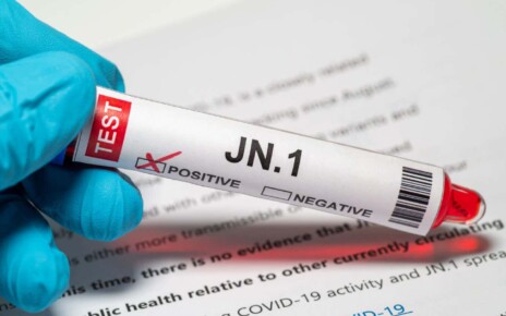 Covid-19 variant JN.1 may be the mildest form of the virus yet