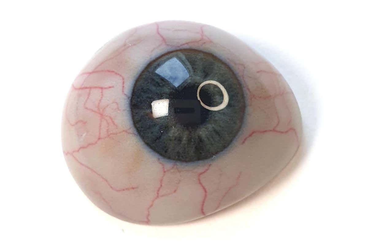 A 3D-printed eye prosthetic designed by AI