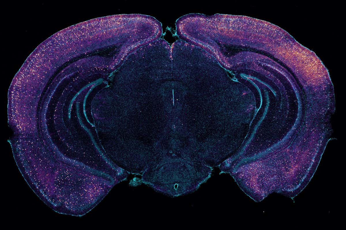 A cross-section of a mouse's brain highlighting neurons that seem to release a molecule that increases toxin clearance