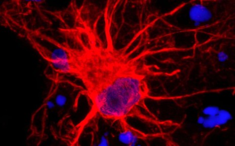 2JKFTNG Researchers study star-shaped brain cells: NIH-funded researchers have used 3D collections of brain tissue from human cells to study star-shaped astrocytes in the brain.