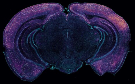 A cross-section of a mouse's brain highlighting neurons that seem to release a molecule that increases toxin clearance