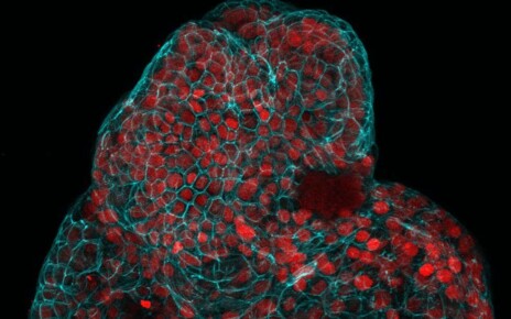Balls of lung cells grown from amniotic fluid. The red indicates lung stem cells