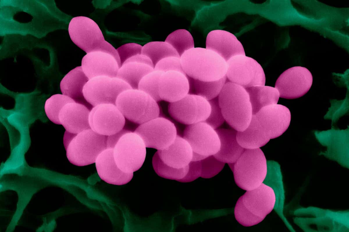 A scanning electron micrograph of Enterococcus faecalis bacteria, which can infect surgery site wounds