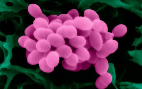 A scanning electron micrograph of Enterococcus faecalis bacteria, which can infect surgery site wounds