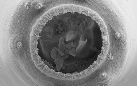 Tiny nematode worms can grow enormous mouths and become cannibals